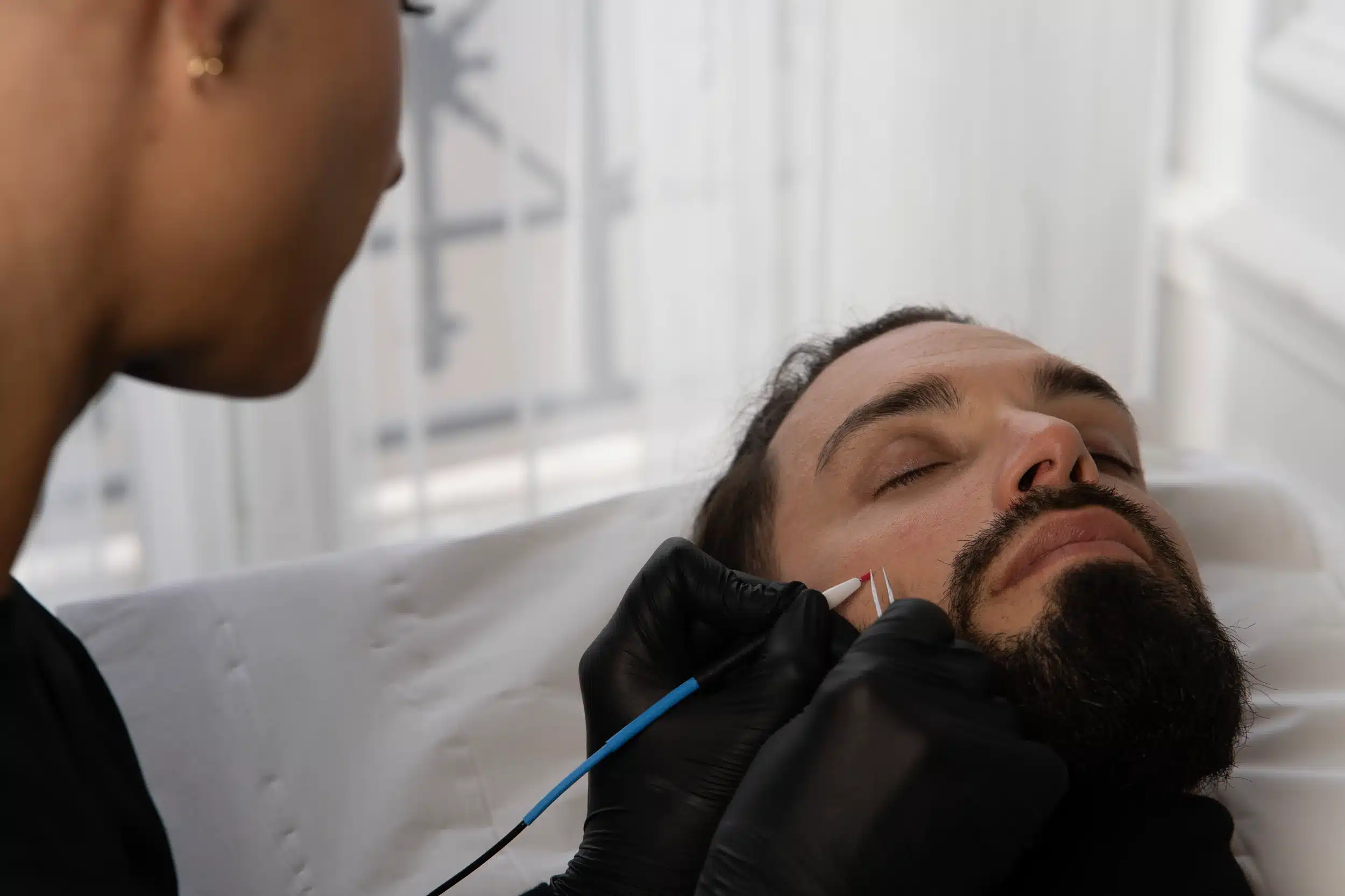 Épilation électrolyse pour homme