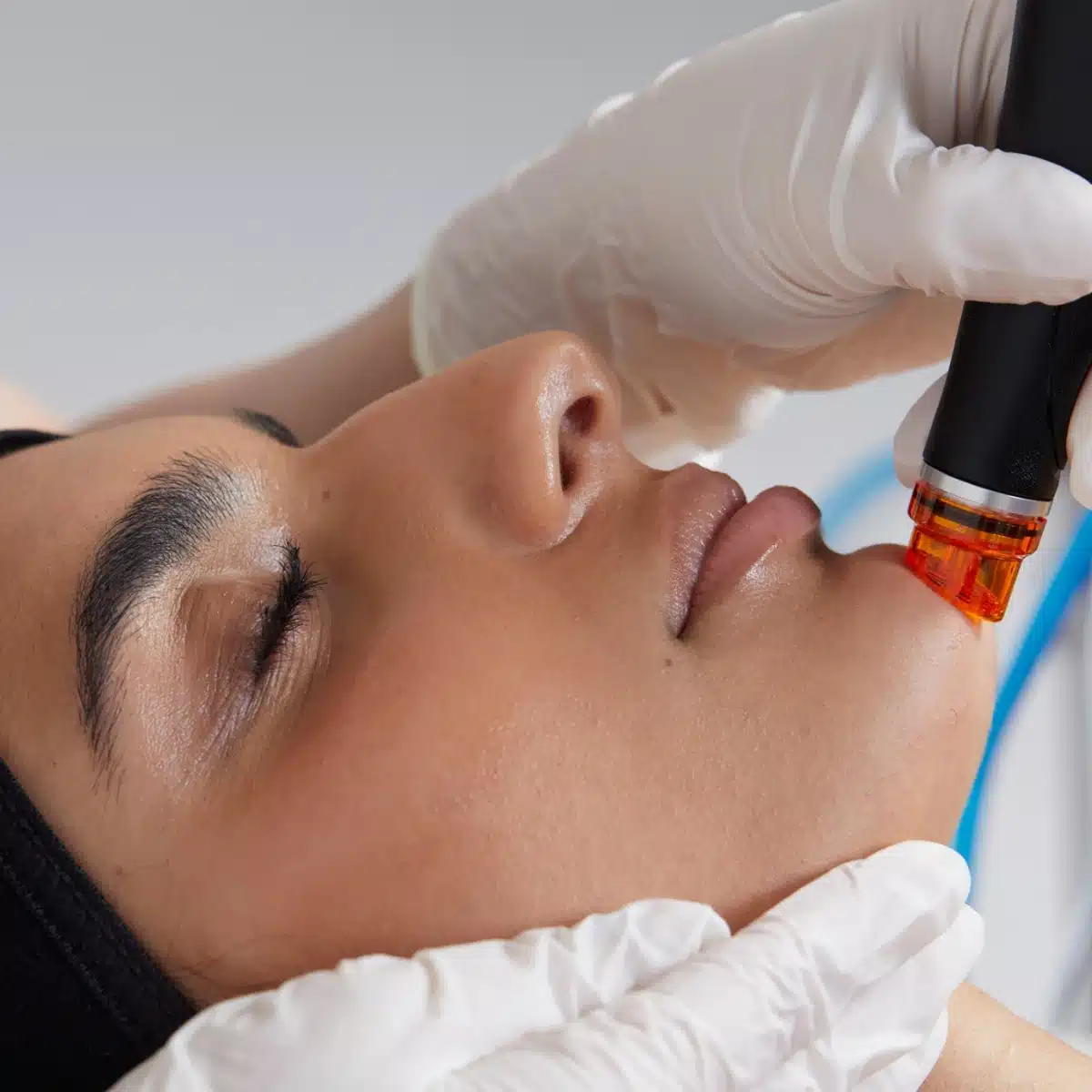Qu'est-ce que le soin Hydrafacial ?