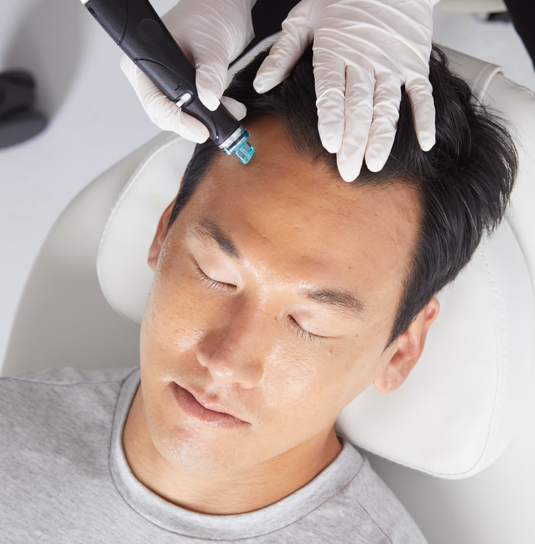Hydrafacial homme : soin visage adapté
